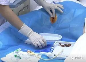 女人导尿视频,专业医疗操作全解析